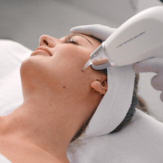 Een vrouw ondergaat een laserbehandeling van haar gezicht